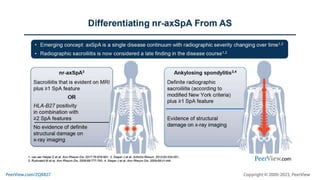 Diagnosing and Managing Axial Spondyloarthritis: The Role of the Primary Care Clinician in Multidisciplinary Care