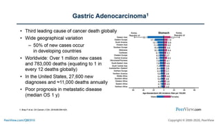 Optimizing Precision Medicine in Gastric Cancer Care: Latest and ...