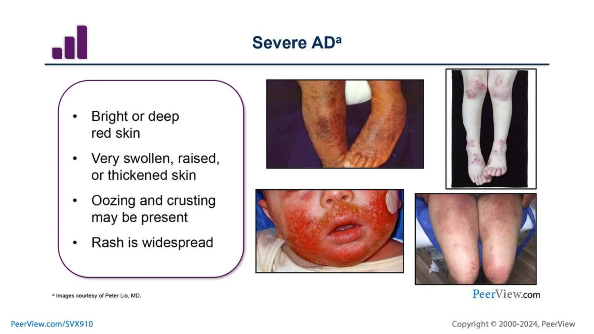 Evolving Concepts in the Pathogenesis of Inflammatory Dermatologic ...