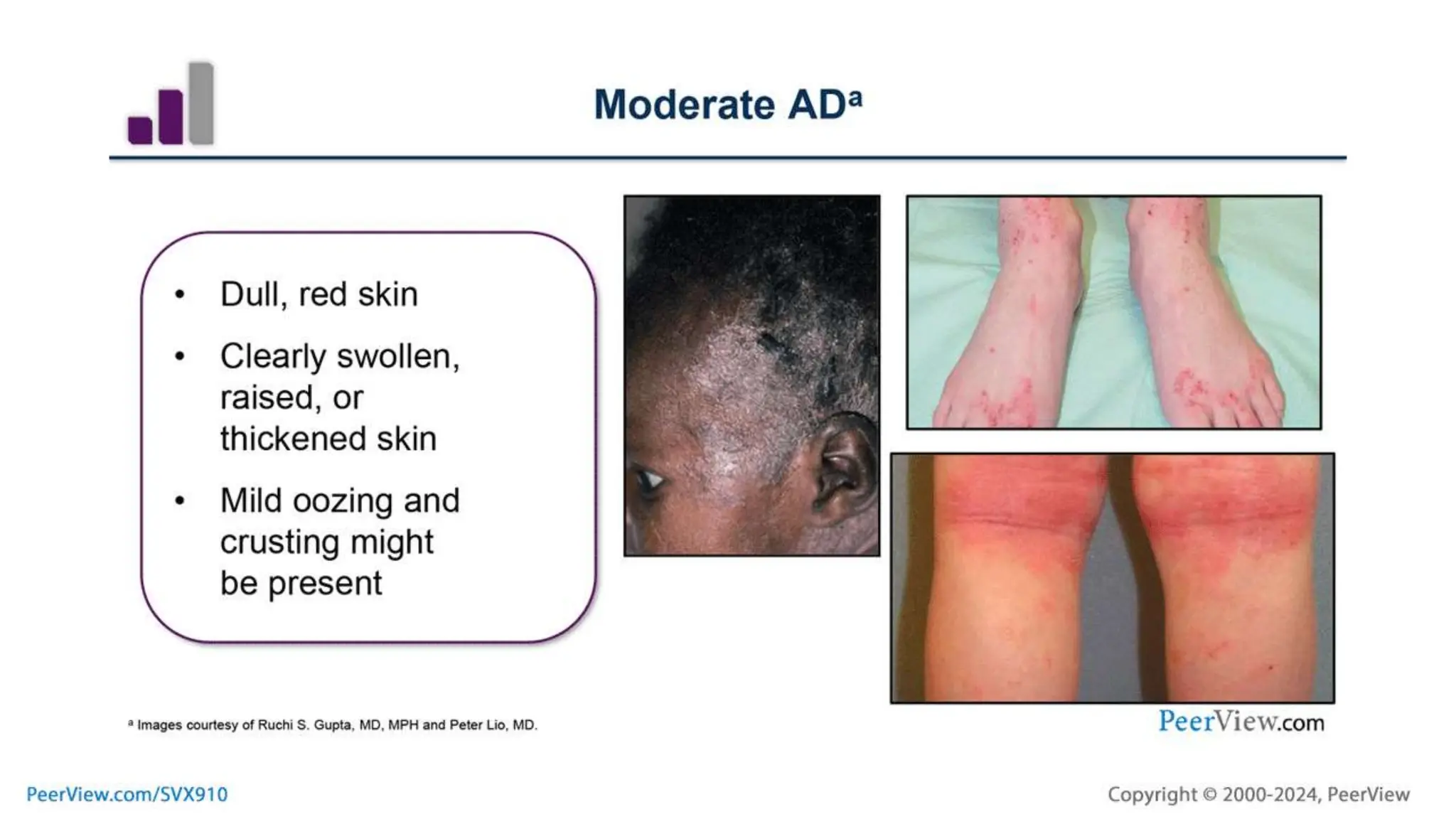 Evolving Concepts in the Pathogenesis of Inflammatory Dermatologic ...