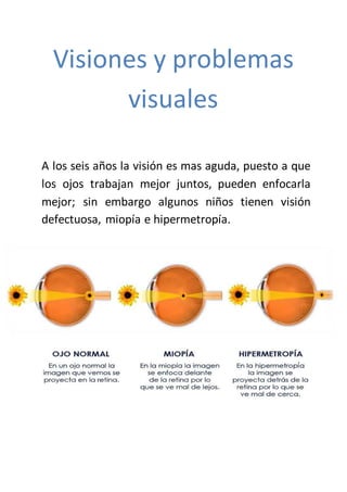 Visiones y problemas
visuales
A los seis años la visión es mas aguda, puesto a que
los ojos trabajan mejor juntos, pueden enfocarla
mejor; sin embargo algunos niños tienen visión
defectuosa, miopía e hipermetropía.
 