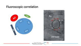 Percutanous PVL closure