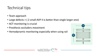 Percutanous PVL closure