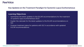 Key Updates on the Treatment Paradigm for Systemic Lupus Erythematosus