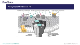 Disruption at the Neuromuscular Junction: Relevance of Autoantibodies ...