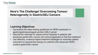 Here’s The Challenge! Overcoming Tumour Heterogeneity in Gastric/GEJ Cancers