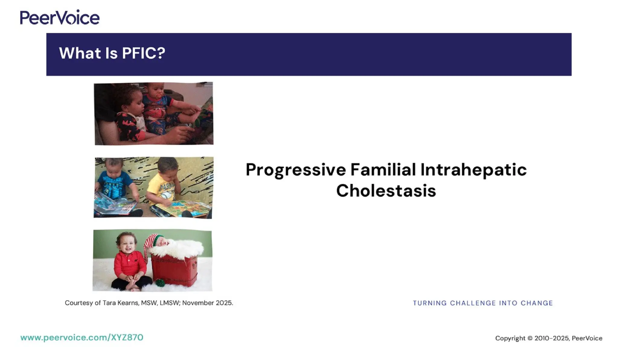 Advancing the Management of Cholestatic Liver Disease: Optimizing ...