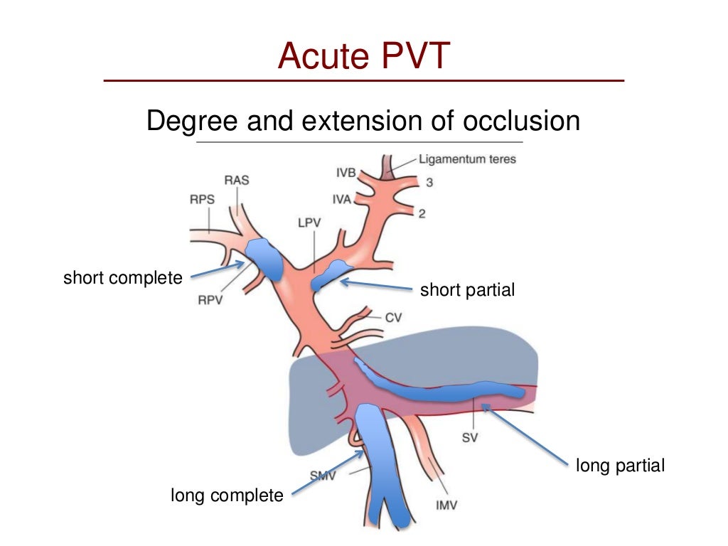 Portal vein thrombosis scenarios and principles of treatment