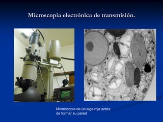 Microscopia electrónica de transmisión. 
Microscopia de un alga roja antes de formar su pared  
