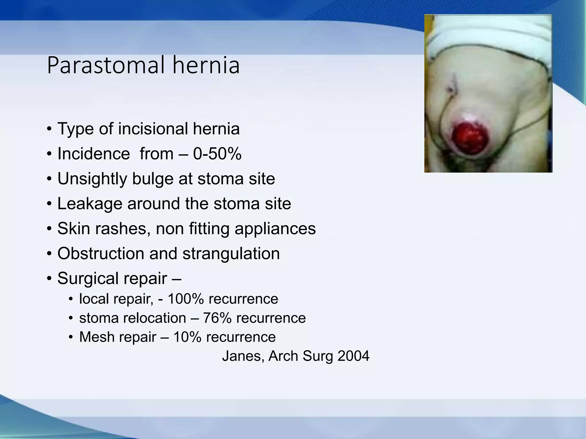 Parastomal hernia
• Type of incisional hernia
• Incidence from – 0-50%
• Unsightly bulge at stoma site
• Leakage around the stoma site
• Skin rashes, non fitting appliances
• Obstruction and strangulation
• Surgical repair –
• local repair, - 100% recurrence
• stoma relocation – 76% recurrence
• Mesh repair – 10% recurrence
Janes, Arch Surg 2004
 