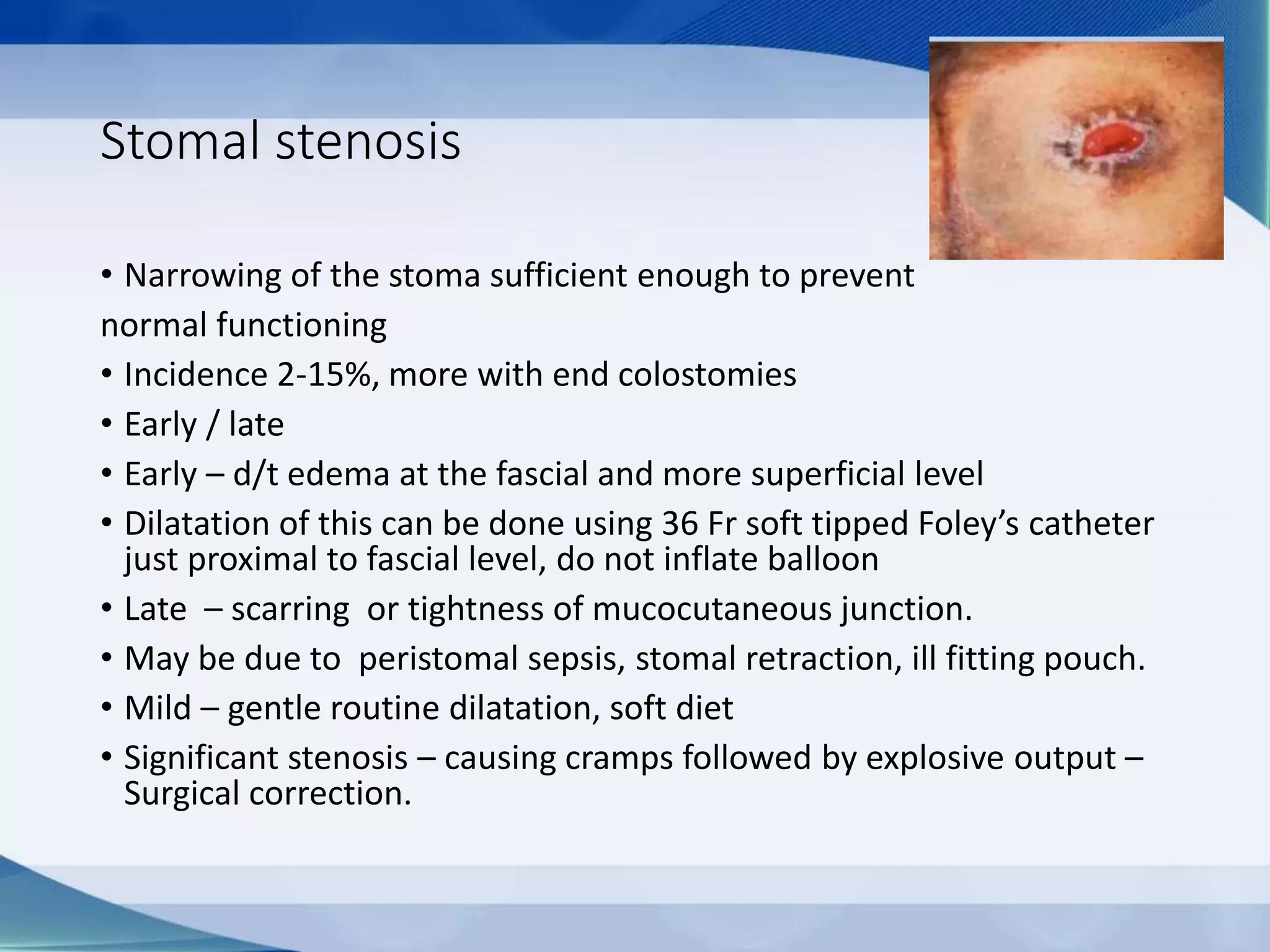 Stomal stenosis
• Narrowing of the stoma sufficient enough to prevent
normal functioning
• Incidence 2-15%, more with end colostomies
• Early / late
• Early – d/t edema at the fascial and more superficial level
• Dilatation of this can be done using 36 Fr soft tipped Foley’s catheter
just proximal to fascial level, do not inflate balloon
• Late – scarring or tightness of mucocutaneous junction.
• May be due to peristomal sepsis, stomal retraction, ill fitting pouch.
• Mild – gentle routine dilatation, soft diet
• Significant stenosis – causing cramps followed by explosive output –
Surgical correction.
 