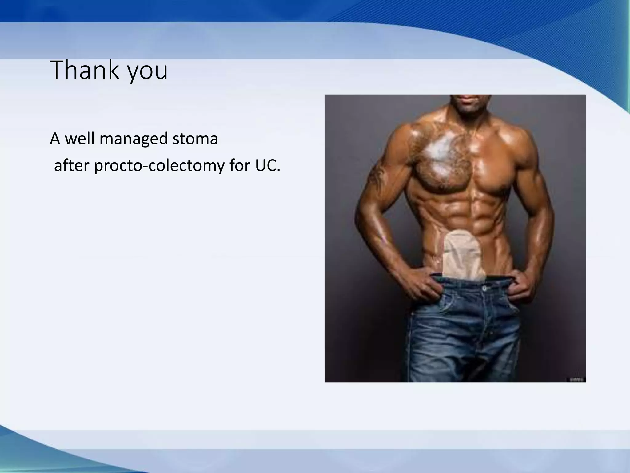 Thank you
A well managed stoma
after procto-colectomy for UC.
 