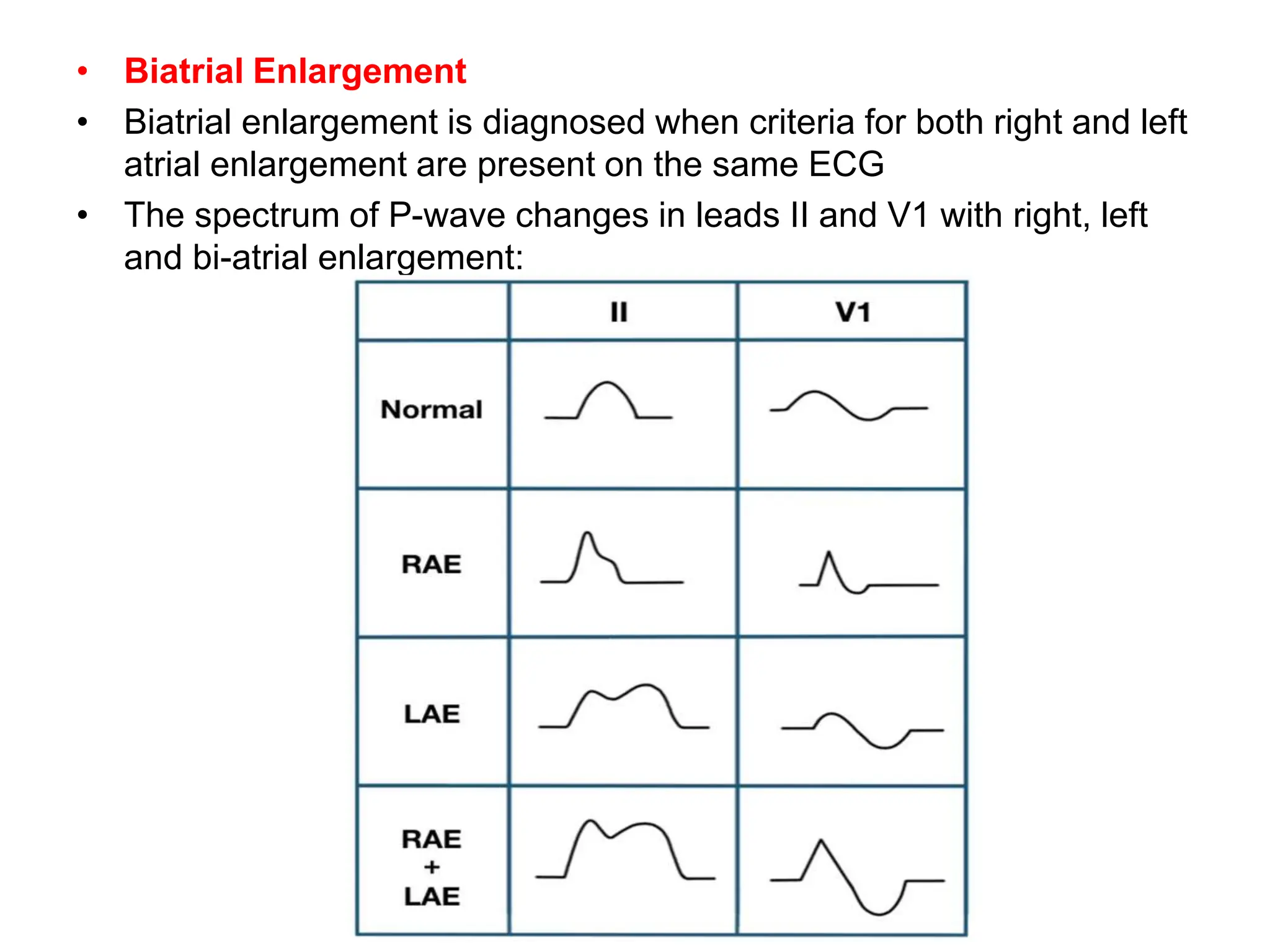 • Biatrial Enlargement
• Biatrial enlargement is diagnosed when criteria for both right and left
atrial enlargement are present on the same ECG
• The spectrum of P-wave changes in leads II and V1 with right, left
and bi-atrial enlargement:
 
