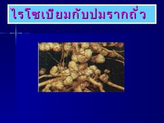 ไรโซเบียมกับปมรากถั่ว 