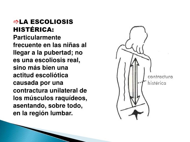 Los ejercicios para el tono sheynogo del departamento