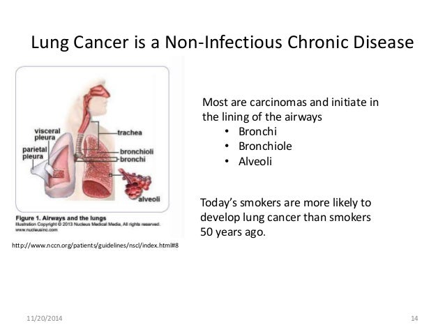 Adenocarcinoma Lung Stage Natural Treatment Adenocarcinoma Lung Stage Natural Treatment