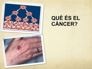 QUÈ ÉS EL
CÀNCER?
 