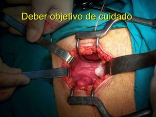 Deber objetivo de cuidado 
