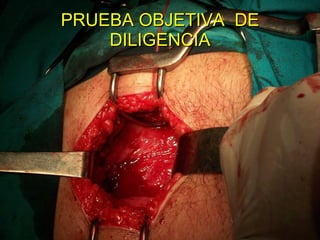 PRUEBA OBJETIVA  DE DILIGENCIA 