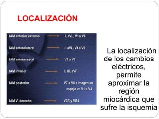 LOCALIZACIÓN
La localización
de los cambios
eléctricos,
permite
aproximar la
región
miocárdica que
sufre la isquemia
 
