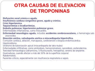 OTRA CAUSAS DE ELEVACION
DE TROPONINAS
 