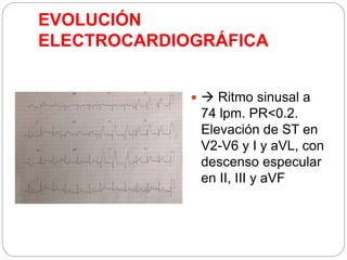 EVOLUCIÓN
ELECTROCARDIOGRÁFICA
  Ritmo sinusal a
74 lpm. PR<0.2.
Elevación de ST en
V2-V6 y I y aVL, con
descenso especular
en II, III y aVF
 