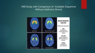 MRI Study with Comparison of Available Dopamine
Without Addictive Stimuli
 