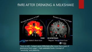 fMRI AFTER DRINKING A MILKSHAKE
*Scan on left – Subject given Milkshake after more than a year of
abstinence from sugar + high palatable foods. Concept of
“sensitivity” and plasticity…
 