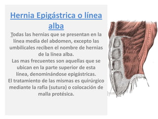 Hernia Epigástrica o línea
alba
Todas las hernias que se presentan en la
línea media del abdomen, excepto las
umbilicales reciben el nombre de hernias
de la línea alba.
Las mas frecuentes son aquellas que se
ubican en la parte superior de esta
línea, denominándose epigástricas.
El tratamiento de las mismas es quirúrgico
mediante la rafia (sutura) o colocación de
malla protésica.
 