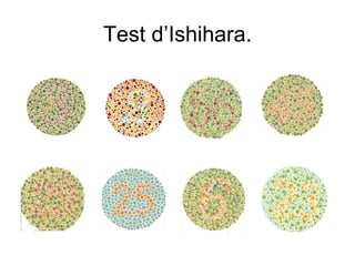 Test d’Ishihara. 