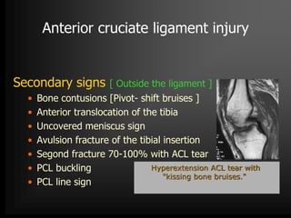 MRI of Knee joint-- hossam massoud | PPTX