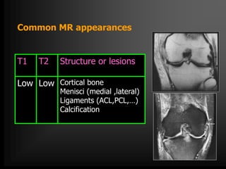MRI of Knee joint-- hossam massoud | PPTX