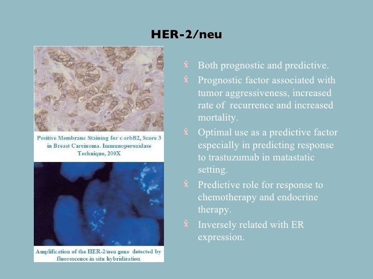 Thesis about breast cancer