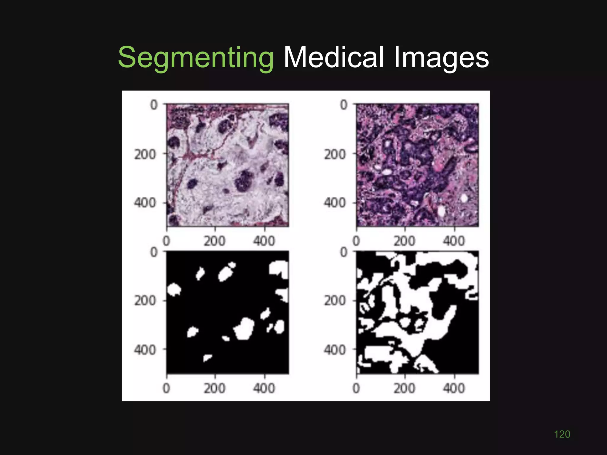 Segmenting Medical Images
TODO
120
 