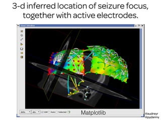 @audreyr
@pydanny
3-d inferred location of seizure focus,
together with active electrodes.
Matplotlib
 