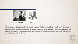 Figura 1 Figura 2
Al terminar las pruebas clínicas, aplicadas a una muestra de pacientes, respiraban mejor, necesitaban menos
medicamentos y disfrutaban de más días sin síntomas, afirmó el investigador Gerard Cox. Actualmente se
están realizando estudios más amplios, se esperan resultados definitivos de 0-2 años. Cabe mencionar que
esta técnica presenta ciertos riesgos y que sólo los médicos especialistas pueden determinar qué pacientes
son factibles de aplicar la técnica.
 