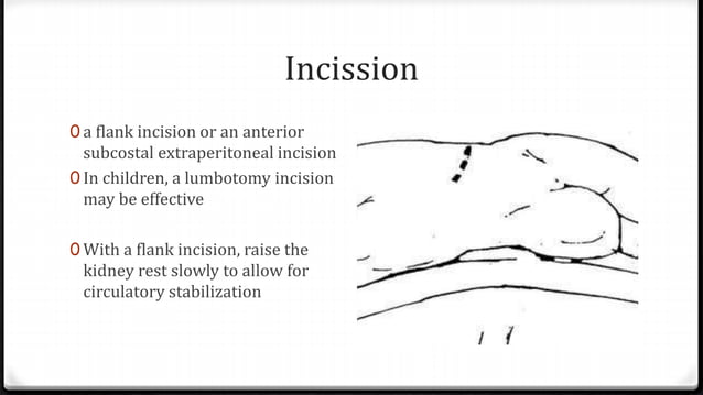 Open Pyelolithotomy | PPTX