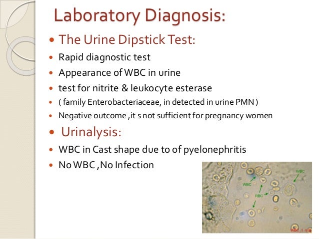 Pyelonephritis case study pdf picture