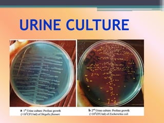 URINE CULTURE
 