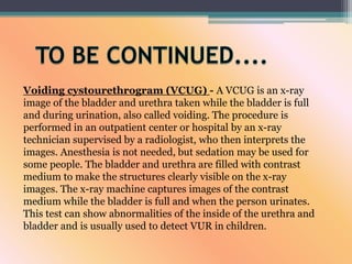 Voiding cystourethrogram (VCUG) - A VCUG is an x-ray
image of the bladder and urethra taken while the bladder is full
and during urination, also called voiding. The procedure is
performed in an outpatient center or hospital by an x-ray
technician supervised by a radiologist, who then interprets the
images. Anesthesia is not needed, but sedation may be used for
some people. The bladder and urethra are filled with contrast
medium to make the structures clearly visible on the x-ray
images. The x-ray machine captures images of the contrast
medium while the bladder is full and when the person urinates.
This test can show abnormalities of the inside of the urethra and
bladder and is usually used to detect VUR in children.
 