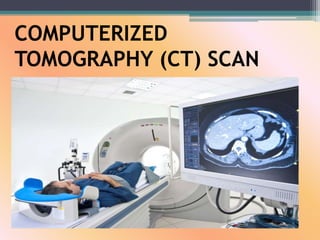 COMPUTERIZED
TOMOGRAPHY (CT) SCAN
 