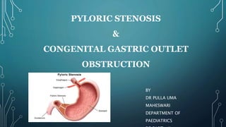 PYLORIC STENOSIS
&
CONGENITAL GASTRIC OUTLET
OBSTRUCTION
BY
DR PULLA UMA
MAHESWARI
DEPARTMENT OF
PAEDIATRICS
 