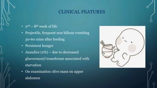 CLINICAL FEATURES
• 2nd – 8th week of life
• Projectile, frequent non bilious vomiting
30-60 mins after feeding
• Persistent hunger
• Jaundice (2%) – due to decreased
glucoronosyl transferase associated with
starvation
• On examination olive mass on upper
abdomen
 