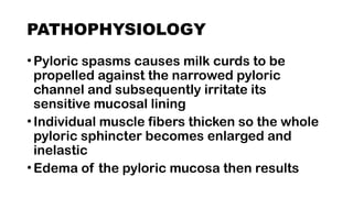 PYLORIC_STENOSIS IN SICK CHILDREN[1].pptx
