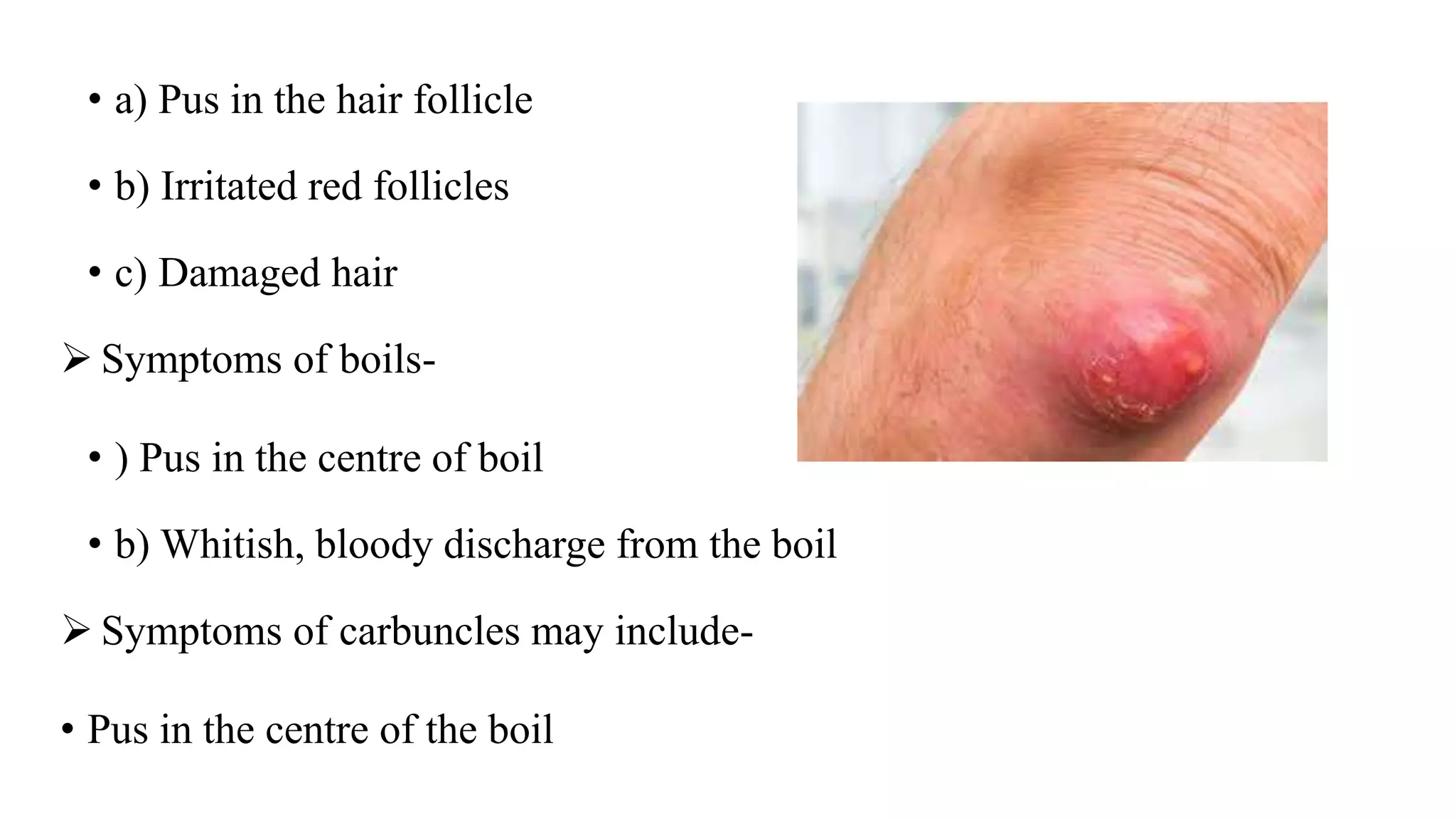• a) Pus in the hair follicle
• b) Irritated red follicles
• c) Damaged hair
 Symptoms of boils-
• ) Pus in the centre of boil
• b) Whitish, bloody discharge from the boil
 Symptoms of carbuncles may include-
• Pus in the centre of the boil
 