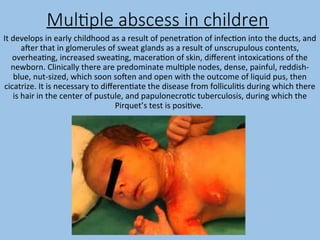 Multiple Abscess pyoderma and scabies.ppttvtfvftvftvtfbgbyhhyhyhyh | PPT