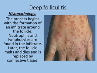 pyoderma and scabies.ppttvtfvftvftvtfbgbyhhyhyhyh | PPT