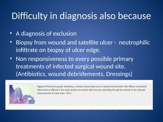 Pyoderma gangrenosum and Post Surgical Pyoderma Gangrenosum | PPTX