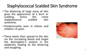Staphylococcal Scalded Skin Syndrome
• The blistering of large areas of skin
gives the appearance of a burn or
scalding, hence the name
staphylococcal scalded skin
syndrome.
• Predominantly seen in infants and
children <5 years
• These toxins then spread to the skin
via the circulating blood and target
the desmoglein-1 protein in the
epidermis leading to the blistering
and sloughing
28
 