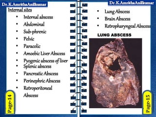 Internal sites
• Internal abscess
• Abdominal
• Sub-phrenic
• Pelvic
• Paracolic
• AmoebicLiver Abscess
• Pyogenicabscess of liver
• Splenic abscess
• PancreaticAbscess
• PerinephricAbscess
• Retroperitoneal
Abscess
• Lung Abscess
• BrainAbscess
• Retropharyngeal Abscess
LUNG ABSCESS
 